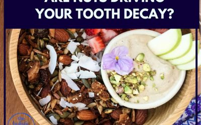 Are nuts driving your tooth decay?